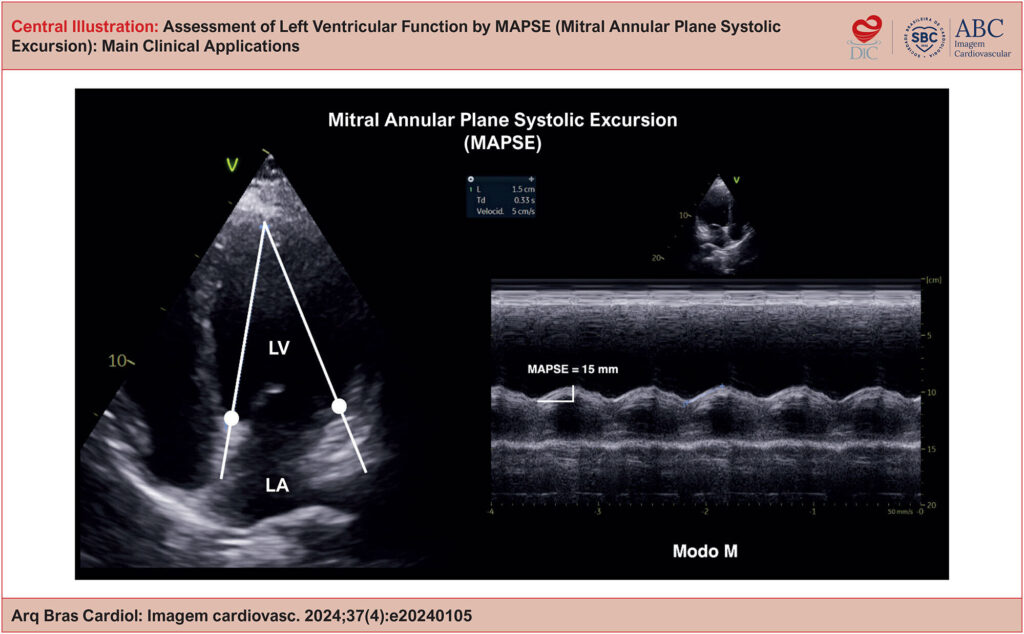 MAPSE septal y lateral por Modo M